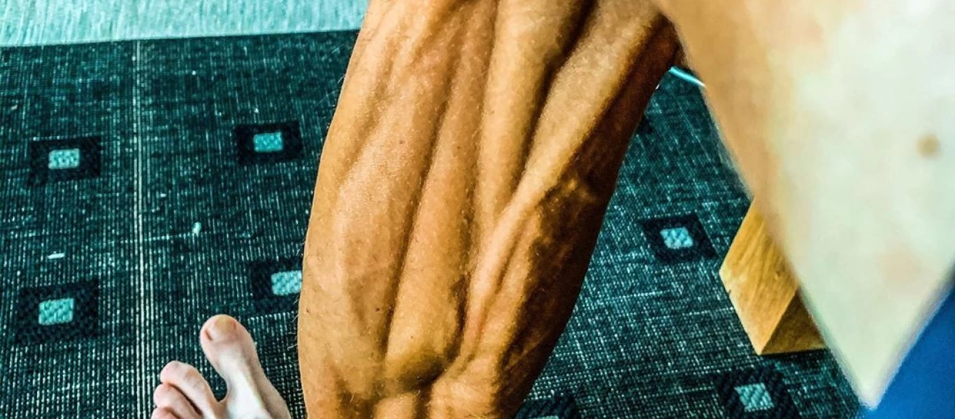 Ανατριχιαστικές εικόνες: Δείτε πως είναι τα παραμορφωμένα πόδια των ποδηλατών μετά τον αγώνα (φώτο)